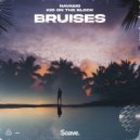 Navagio & Kid On The Block - Bruises ()